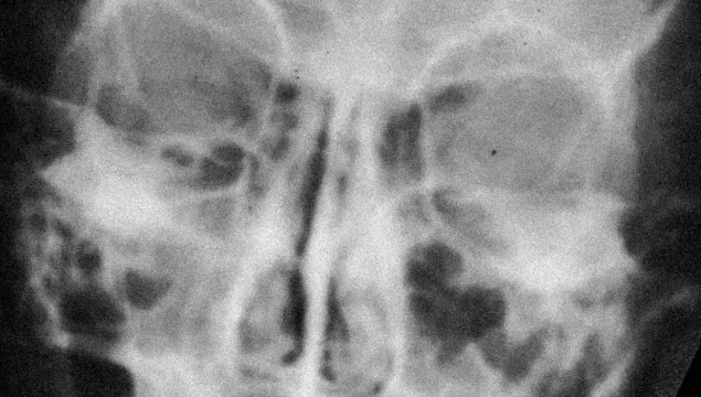 an x-ray of a skull